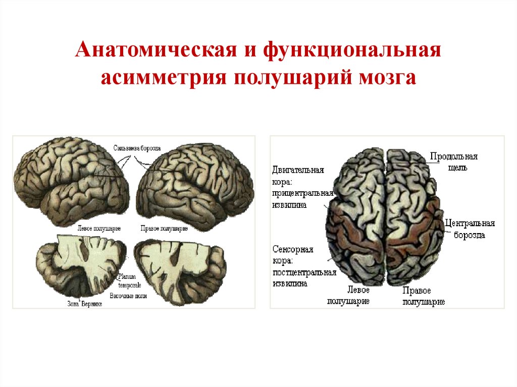 Нарушение коры полушарий. Функциональная асимметрия полушарий головного мозга. Функциональная межполушарная асимметрия головного мозга это. Функциональная асимметрия коры головного мозга. Функциональная асимметрия коры больших полушарий.