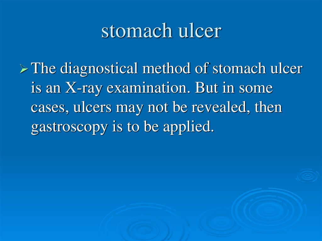 stomach ulcer