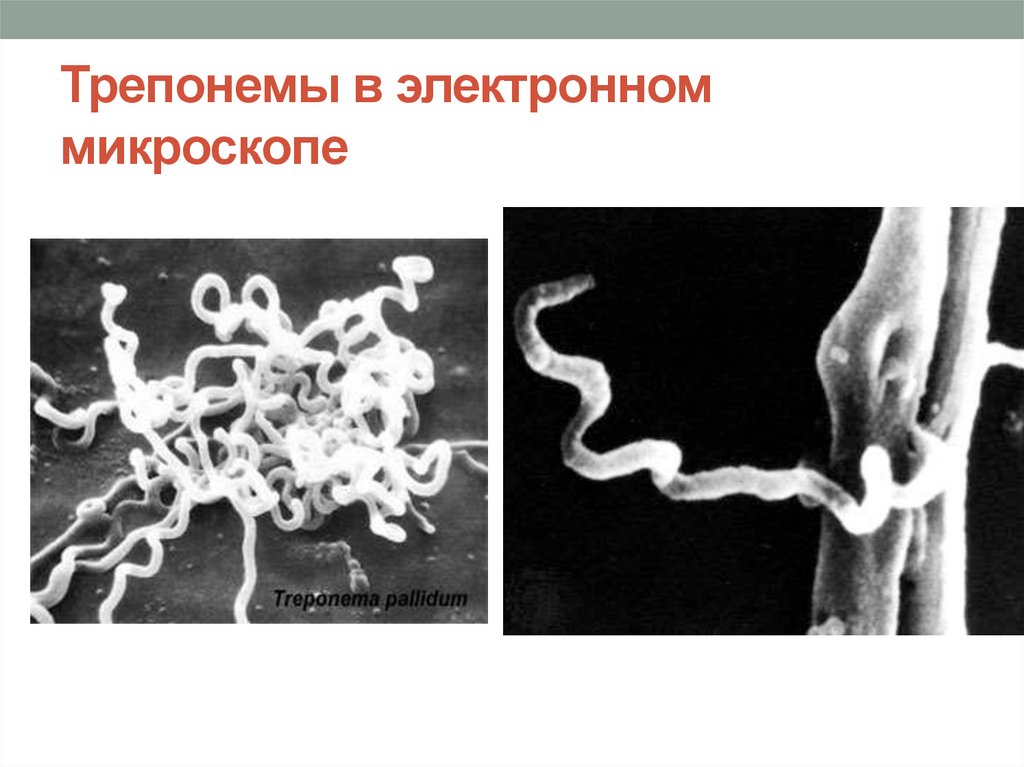 Treponema pallidum в рмп. Бледная трепонема микроскоп. Бледная трепонема это бактерия. Трепонема микроскопия.
