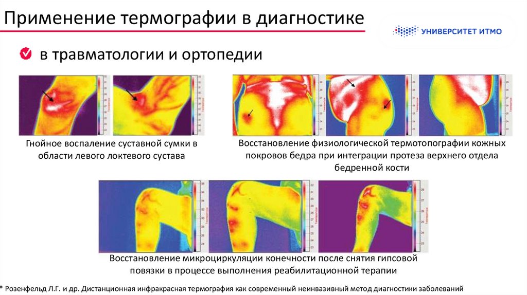 Применение термографии в диагностике