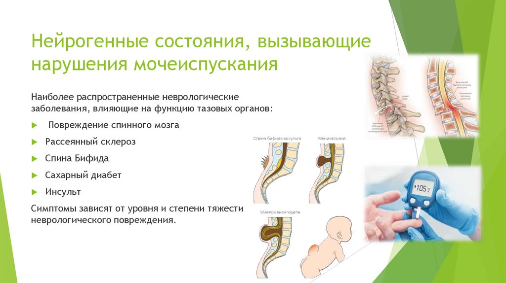 Нейрогенная дисфункция мочевого пузыря код мкб 10. Нейрогенные расстройства мочеиспускания. Центральный Тип нарушения мочеиспускания. Нарушение мочеиспускания мкб 10. Периферический Тип нарушения мочеиспускания.