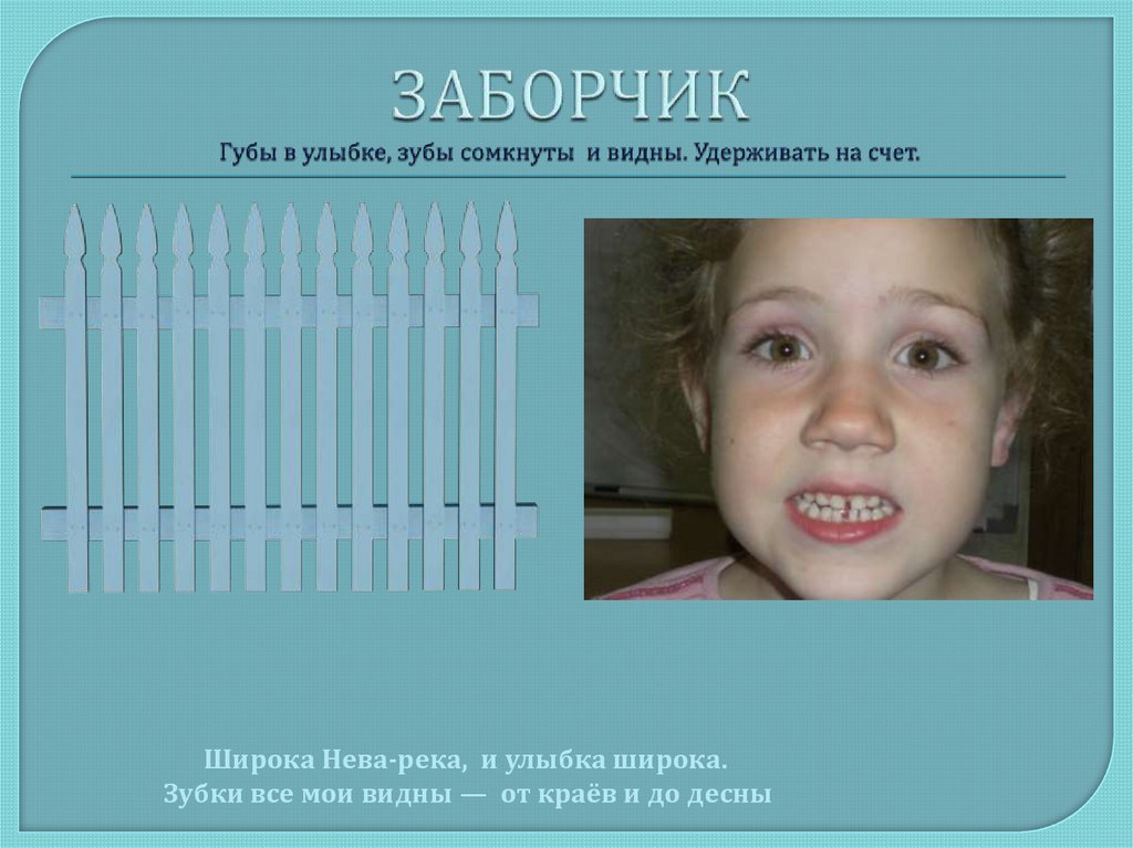 ЗАБОРЧИК Губы в улыбке, зубы сомкнуты и видны. Удерживать на счет.