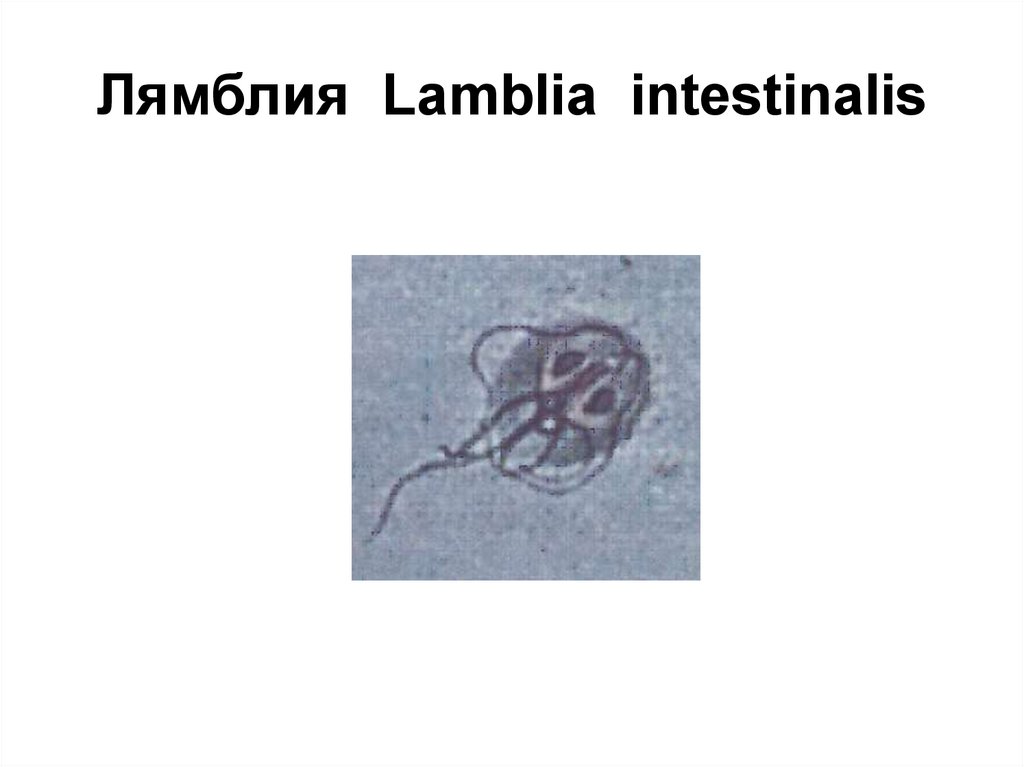 Лямблия тип. Лямблия интестиналис. Lamblia intestinalis Тип. Lamblia intestinalis морфология. Тип лямблия интестиналис.