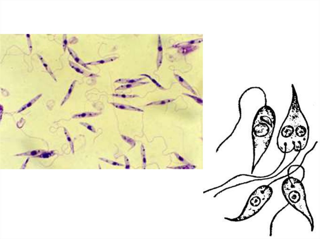 Лейшмания жгутиковая. Лейшмания жизненный цикл. Лейшмания под микроскопом. Класс жгутиковые лейшмании. Лейшмании Тип класс отряд.