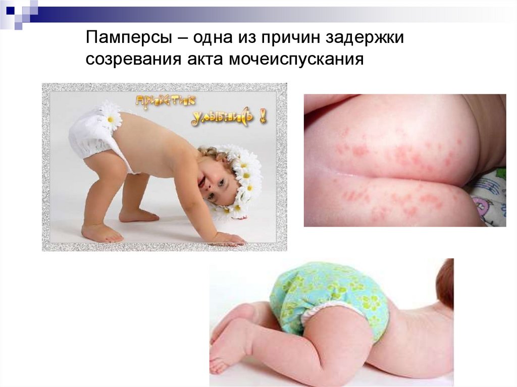 Становление зрелого типа мочеиспускания у детей