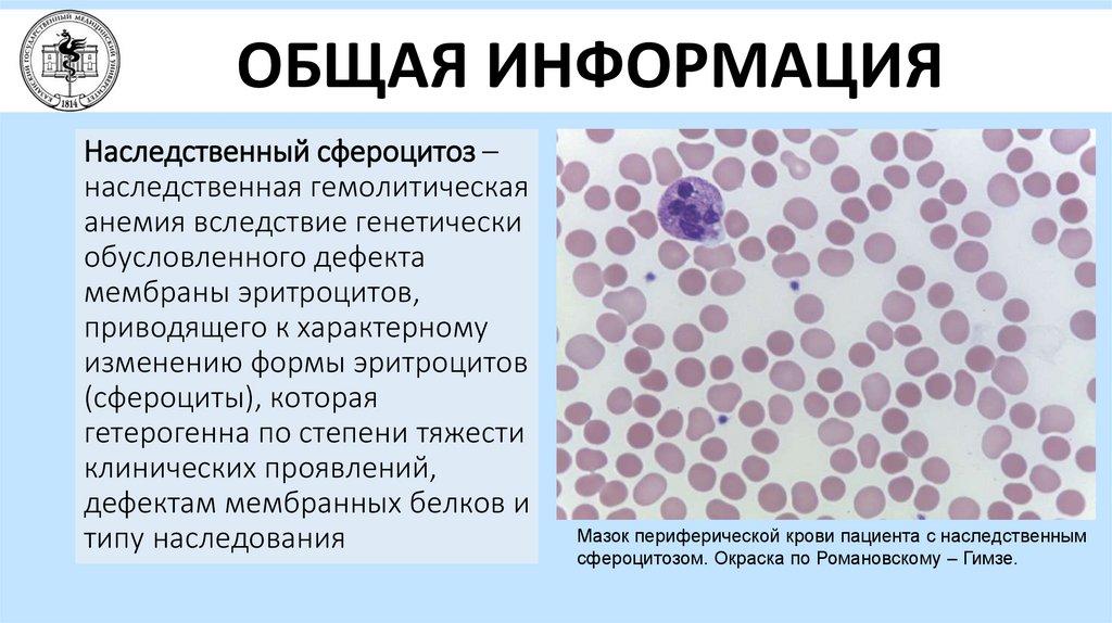 Анемия минковского шоффара у детей