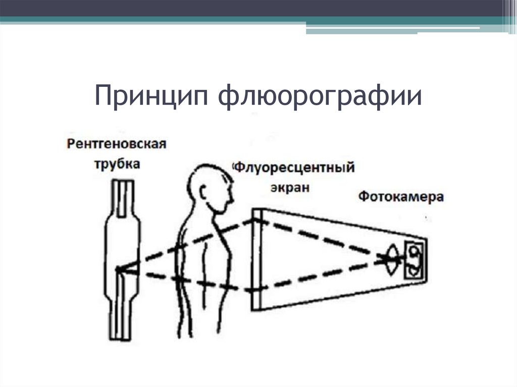 Работа флюорографии. Принцип флюорографии. Флюорография принцип работы. Флюорография схема. • Флюорография. Принцип получения изображения.