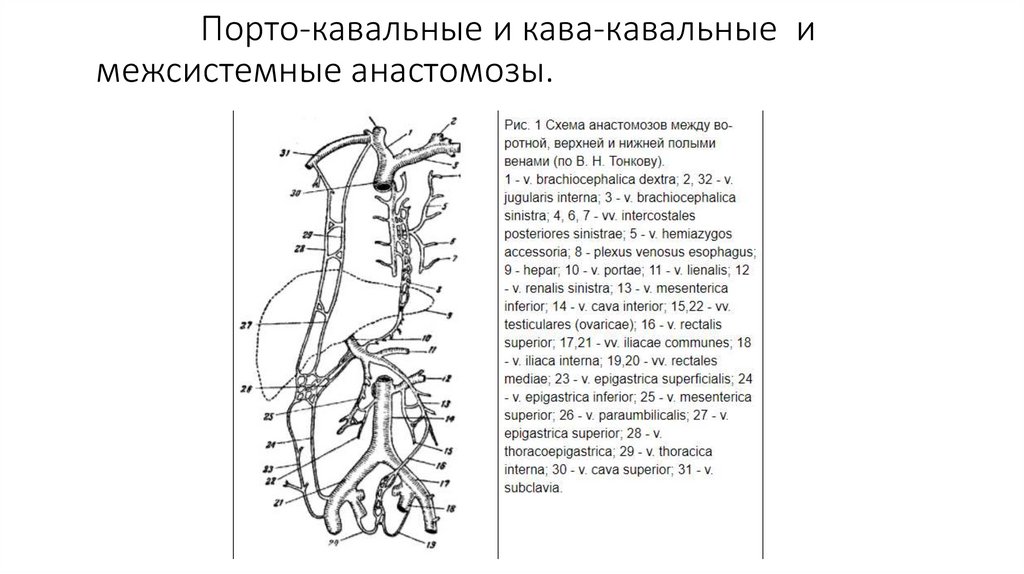 Кава портокавальные. Вены, образующие кава-кавальные анастомозы:. Кавакавальные анастомозы схема. Кава кавальные и портокавальные анастомозы таблица. Портокавальные и кавакавальные анастомозы анатомия таблица.