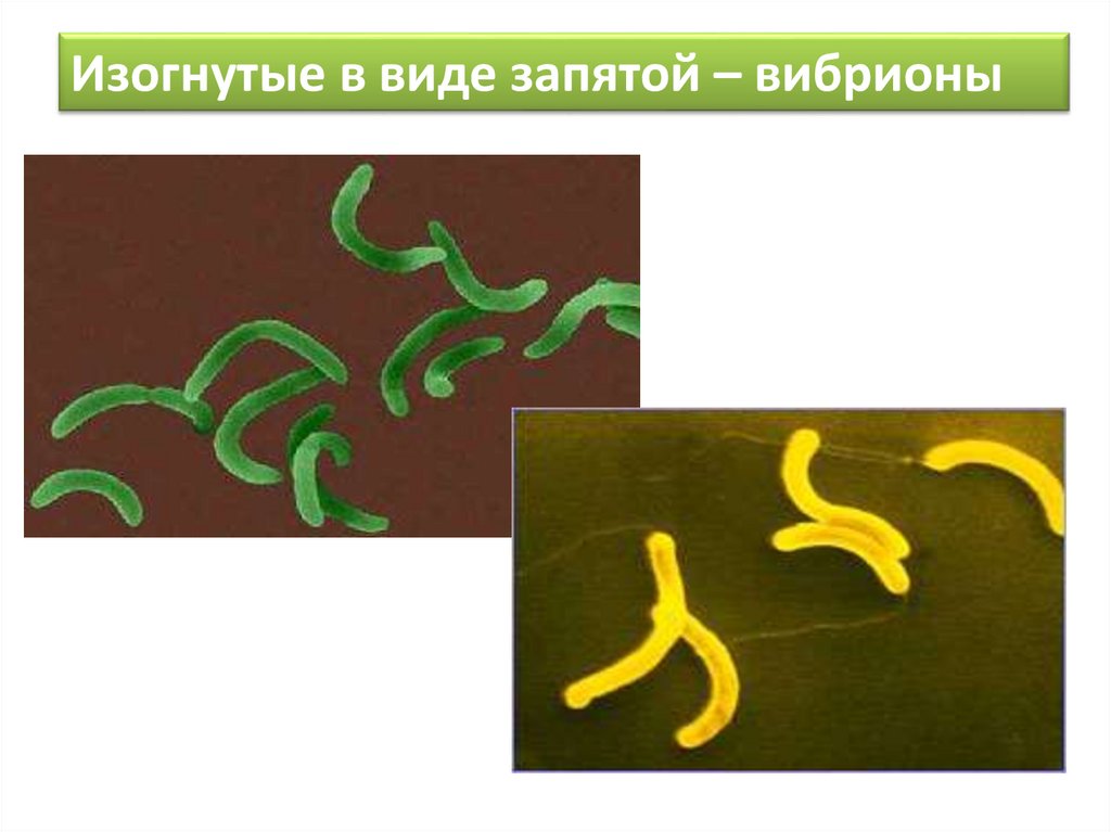 Примитивные организмы. Изогнутые вибрионы. Изогнутые в виде запятой бактерии. Вибрионы в виде запятой. Вибрионы изогнутая в виде.