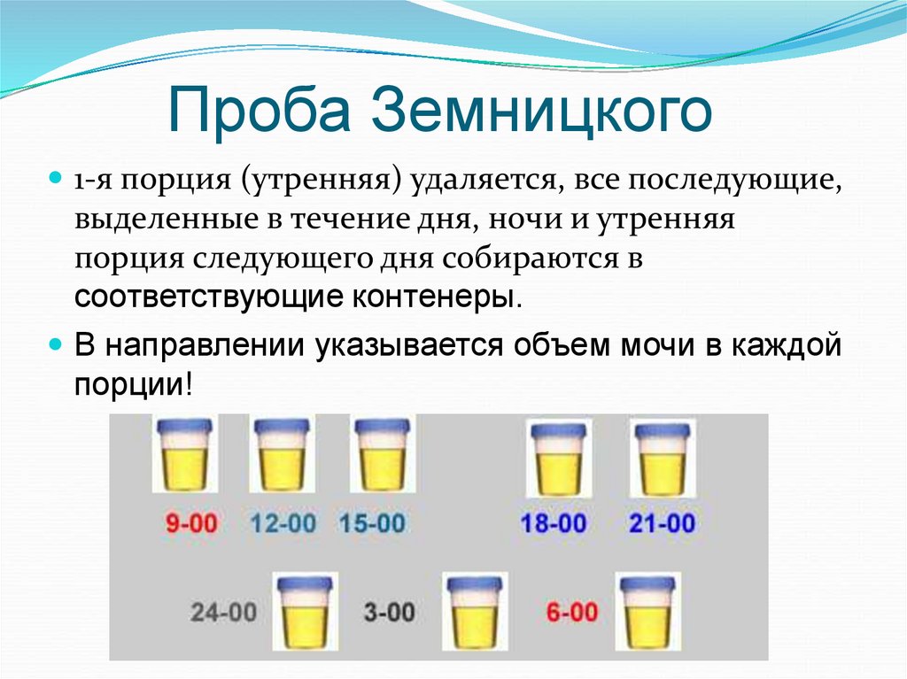 Анализ мочи по зимницкому тест. Проба Зимницкого и Нечипоренко. Проба Зимницкого исследование мочи. Норма дневного диуреза по Зимницкому. Контейнеры для сбора мочи по Зимницкому.