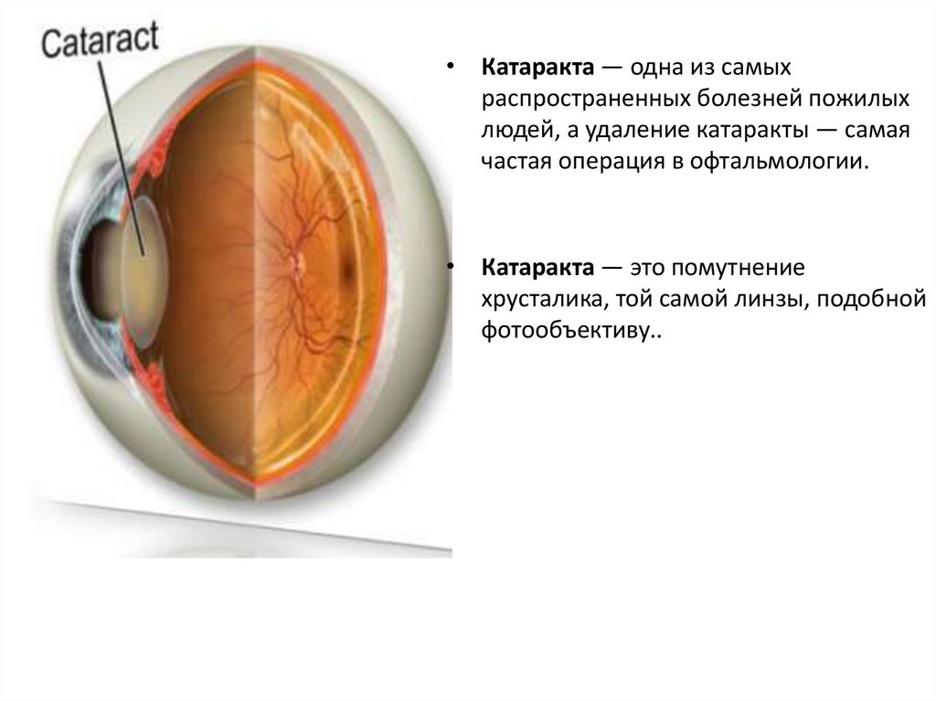 Гигиена зрения предупреждение глазных болезней 8 класс. Гигиена зрения предупреждение глазных болезней презентация 8 класс. Гигиена зрения предупреждение глазных болезней 8 класс таблица.