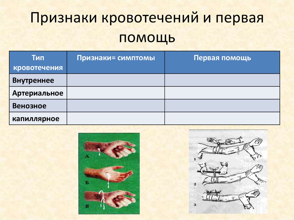 Вид кровотечения признаки меры первой помощи. Кровотечение признаки и первая помощь. Первая помощь при кровотечениях таблица. Симптомы кровотечения делятся на.