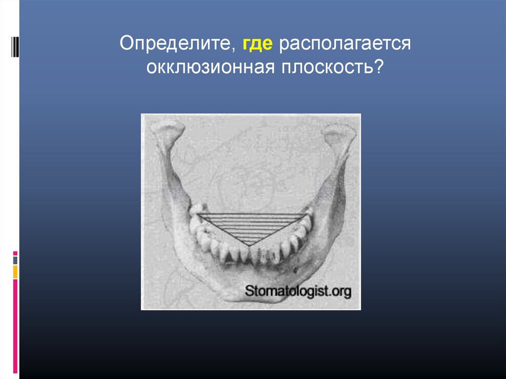 Основы клинической гнатологии биомеханика зубочелюстно лицевой системы презентация