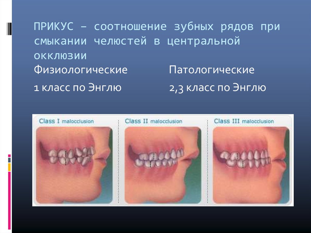 Центральная окклюзия и центральное соотношение