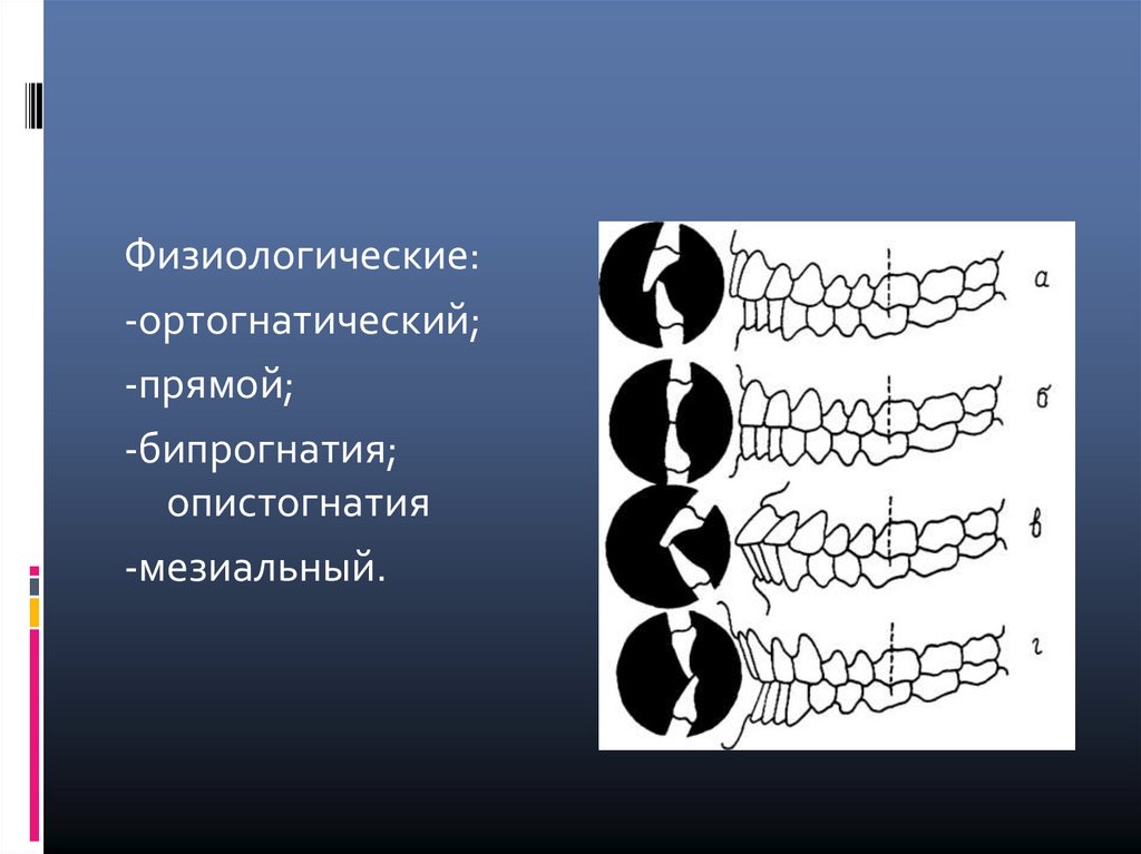 Окклюзия окружения. Физиологическая гипрогнатия. Альвеолярная бипрогнатия. Опистогнатия.