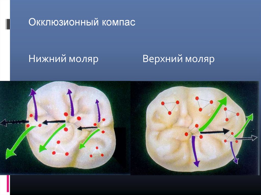 Схема окклюзионных контактов - 87 фото