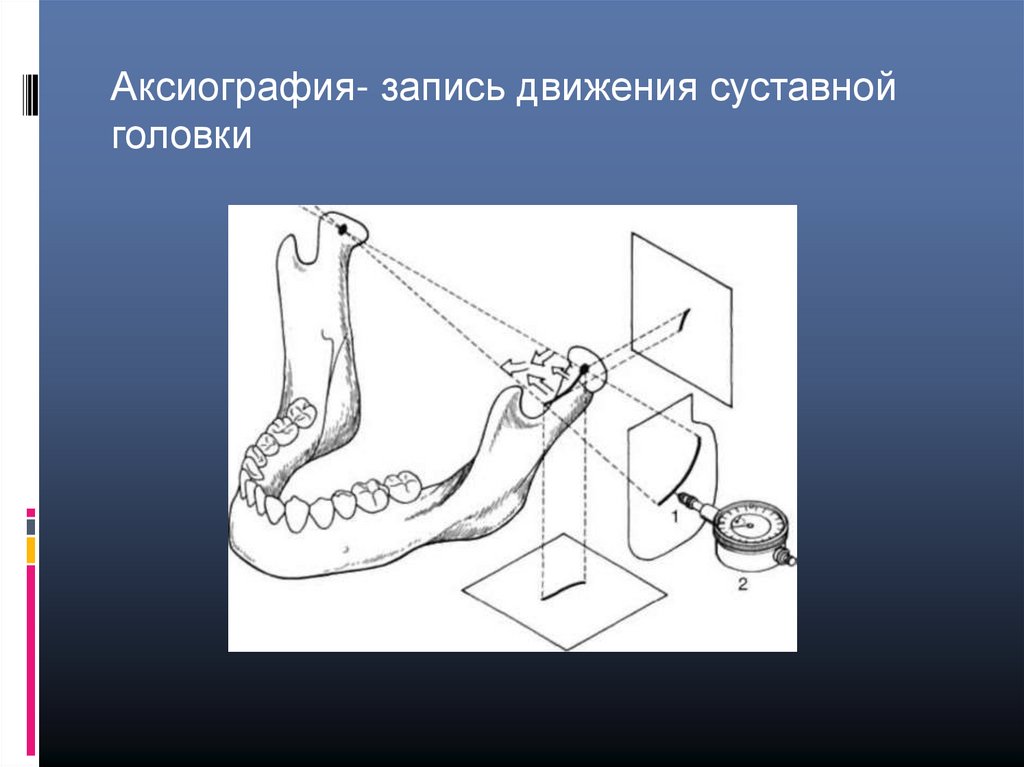 Аксиография в стоматологии презентация