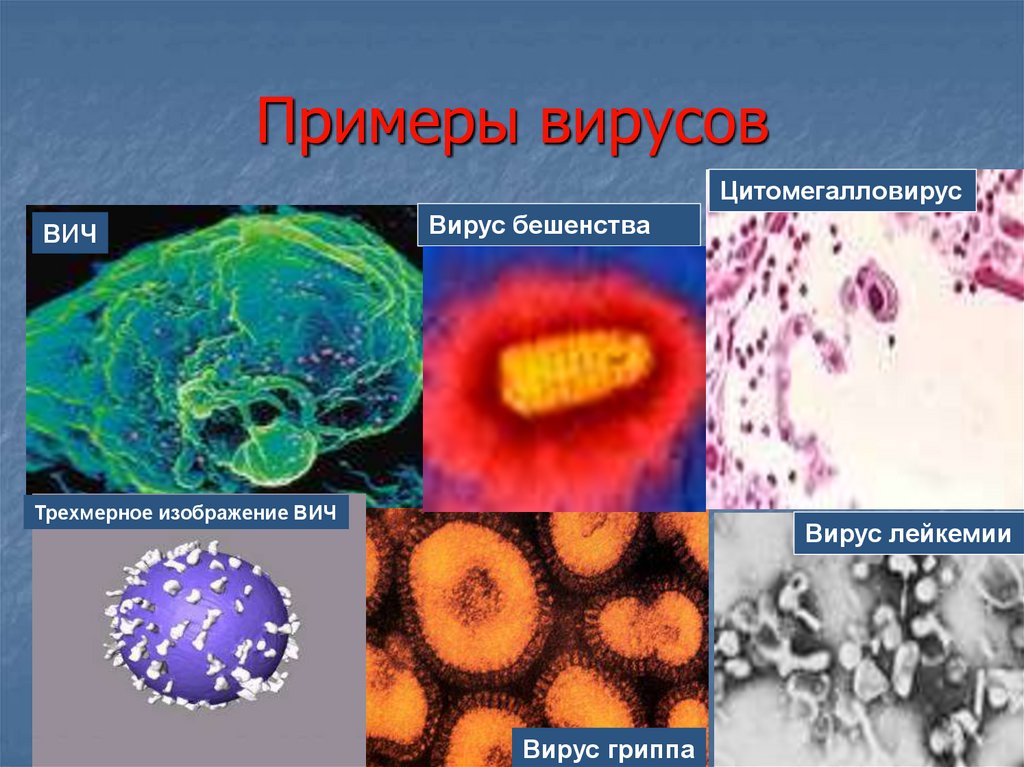 Грипп бешенство. Вирусы примеры. Вирус бешенства под микроскопом. Изображение вируса бешенства.