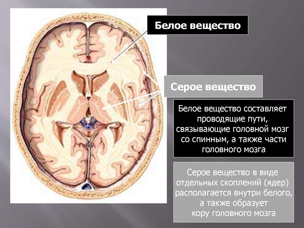 Белое вещество головного мозга. Белое вещество. Отсутствие серого вещества. Волокна белого вещества. Волокна белого вещества головного мозга.