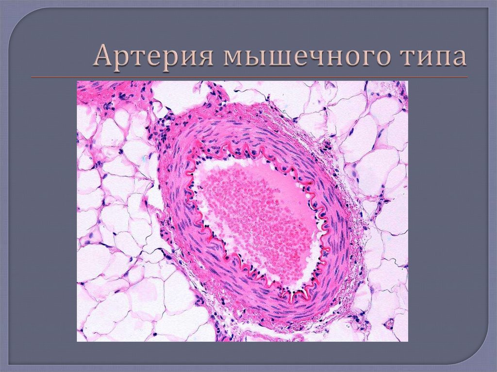 Артерия мышечного типа рисунок