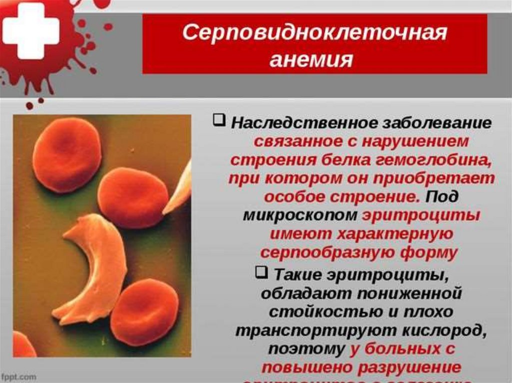 Анемия и эритроциты в крови. Серповидная клеточная анемия причины. Гемоглобин s при серповидноклеточной анемии. Синдром серповидноклеточной анемии причины. Серповидноклеточная анемия клинические проявления.