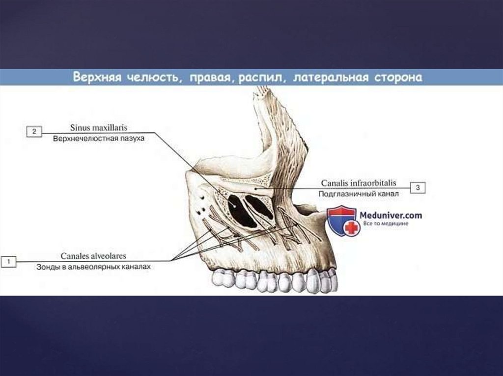 Клыковая ямка. Альвеолярный отросток верхнечелюстной кости. Носовая поверхность тела верхней челюсти. Анатомические структуры верхней челюсти. Верхняя челюсть анатомия носовая поверхность.