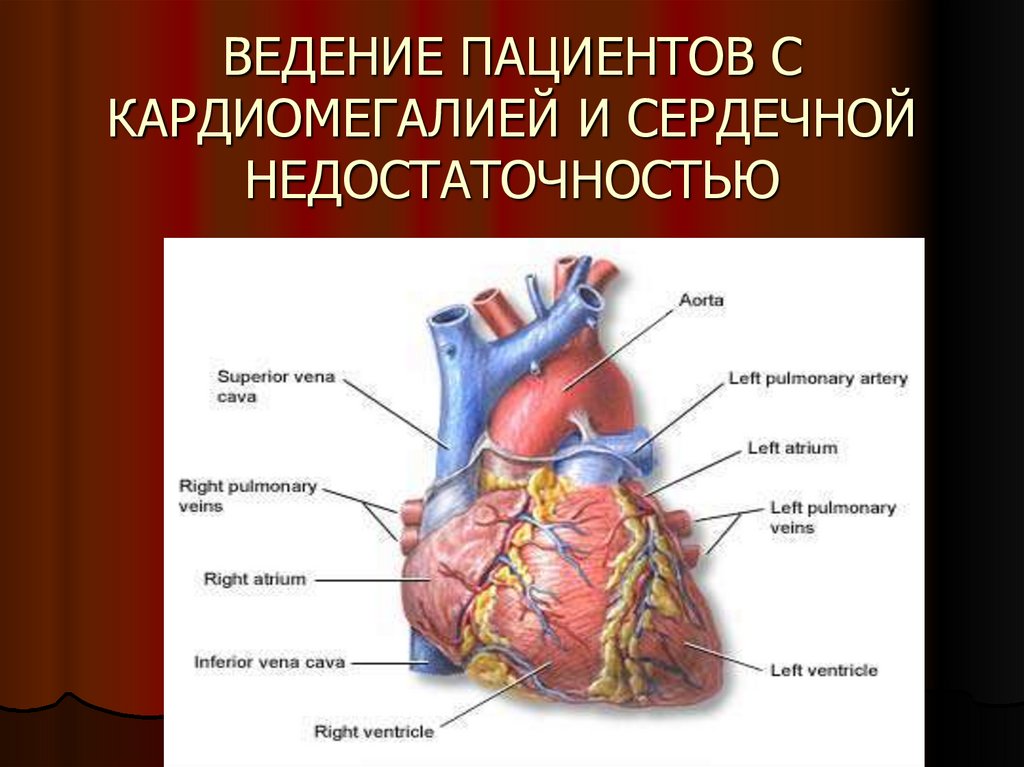 Кардиомегалия. Сердечная недостаточность презентация. Кардиомегалией. Кардиомегалия презентация.