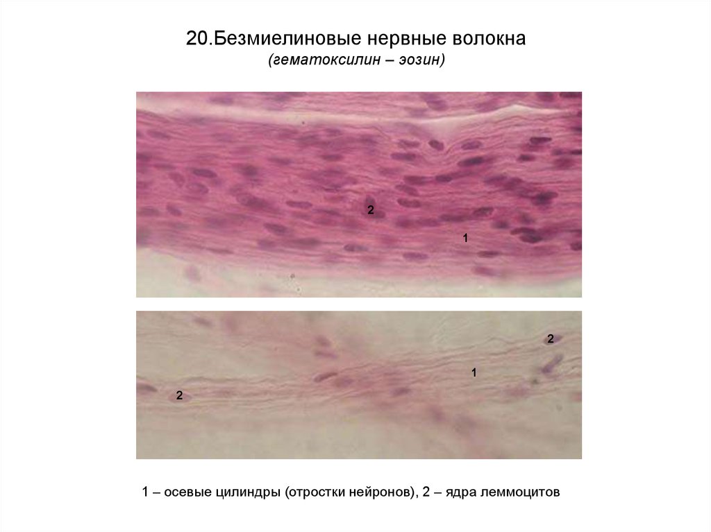 Безмиелиновые нервные волокна гистология рисунок