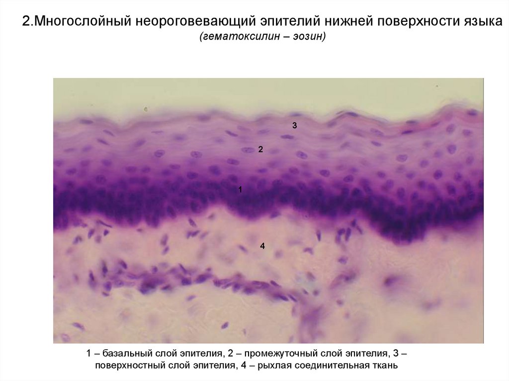 Многослойный плоский неороговевающий эпителий. Многослойный плоский неороговевающий эпителий языка. Многослойный плоский неороговевающий эпителий гистология. Многослойный плоский неороговевающий эпителий гистология препарат. Многослойный плоский неороговевающий эпителий гистология рисунок.