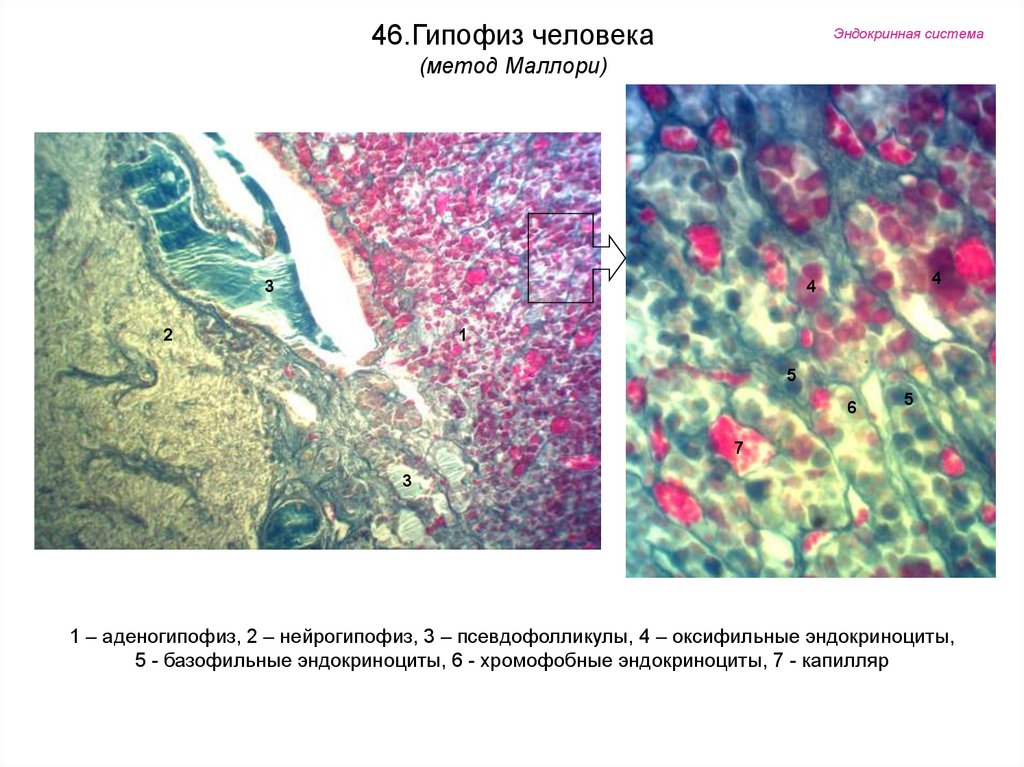 Аденогипофиз рисунок гистология