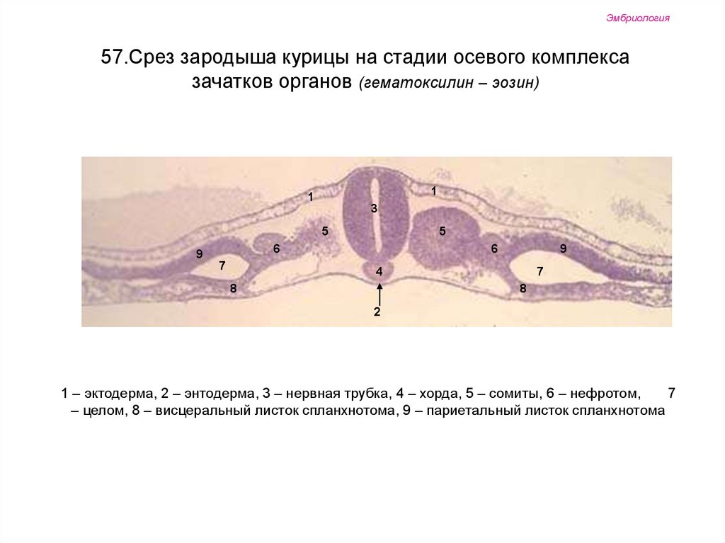 Стадии зародыша курицы. Закладка осевых органов поперечный срез зародыша курицы. Сомиты хорда и нервная трубка зародыша курицы. Осевой комплекс зародыша курицы (гематоксилин). Зародыш курицы на стадии образования осевых зачатков органов.