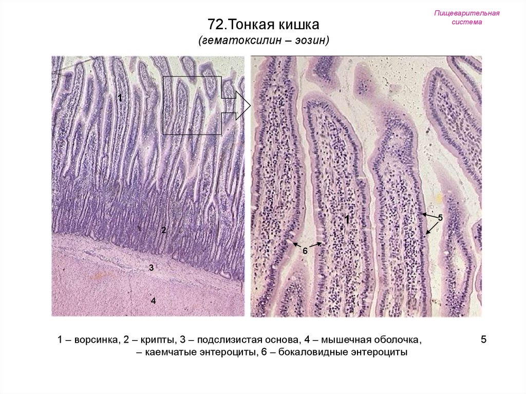 Тонкая кишка гистология рисунок