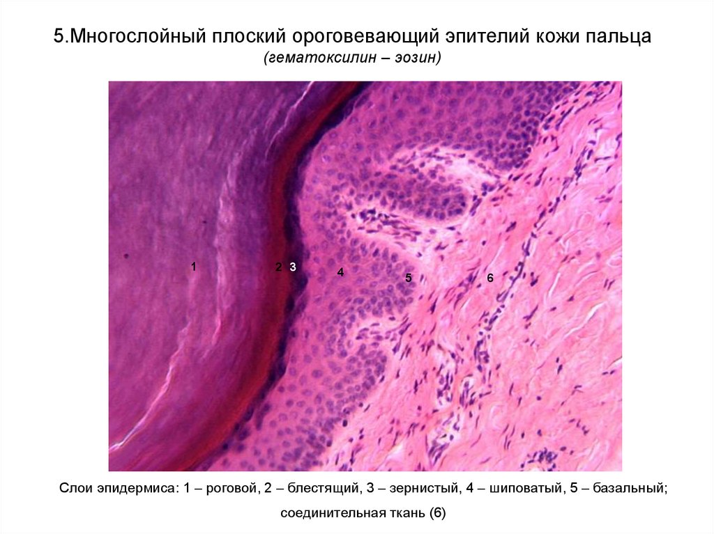 Многослойный ороговевающий эпителий. Многослойный плоский ороговевающий эпителий кожи пальца препарат. Многослойный плоский ороговевающий эпителий препарат гистология. Эпителий кожи пальца гистология препарат. Кожа пальца человека (гематоксилин-эозин).