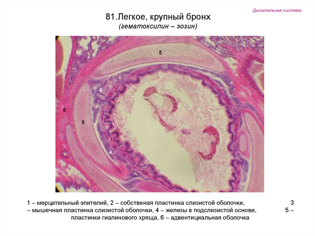 Легкое препарат. Крупный бронх гистология препарат. Бронхи крупного калибра гистология препарат. Бронх гистология препарат. Крупный легочный бронх препарат гистология.