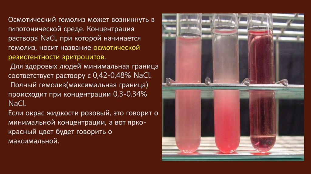 Определение резистентности эритроцитов. Осмотическая резистентность эритроцитов. Определение осмотической устойчивости эритроцитов. Определение осмотической резистентности эритроцитов. Осмотическая резистентность эритроцитов как определить.