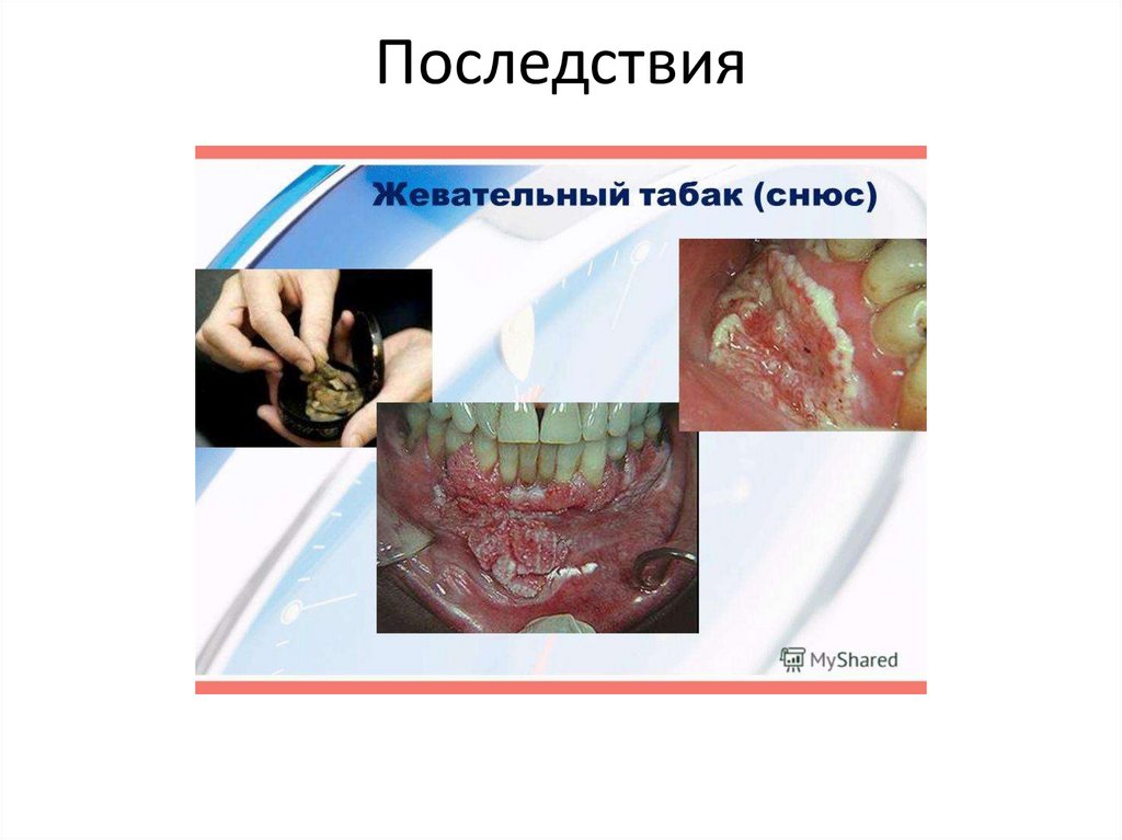 Последствия