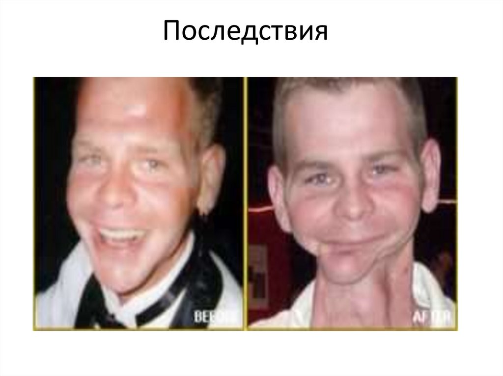 Последствия