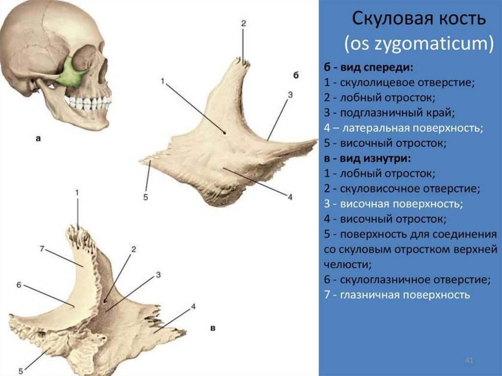 К какому отделу черепа относится скуловая кость. Перелом верхней скуловой кости. Верхняя челюсть анатомия скуловая кость. Скуловой отросток височной кости. Скуловая кость лицевого черепа.