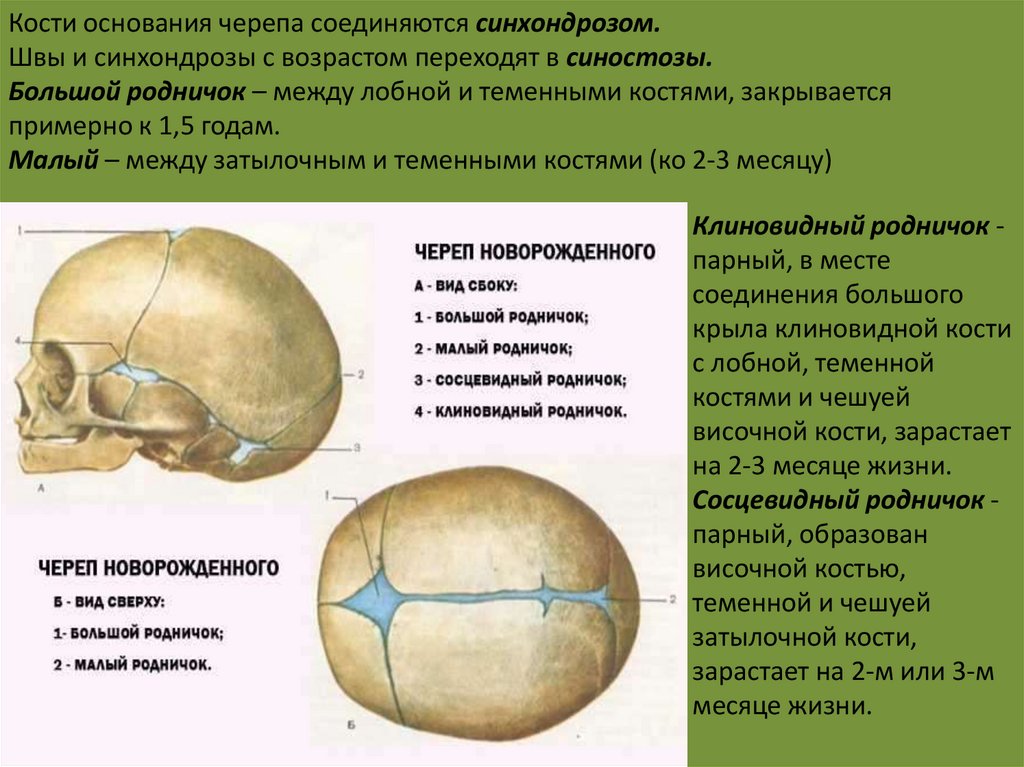 Соединение лобной и теменной кости. Щвы кости черепа новорожденного. Швы черепа анатомия теменная кость. Сосцевидный Родничок черепа. Роднички черепа это синхондроз.