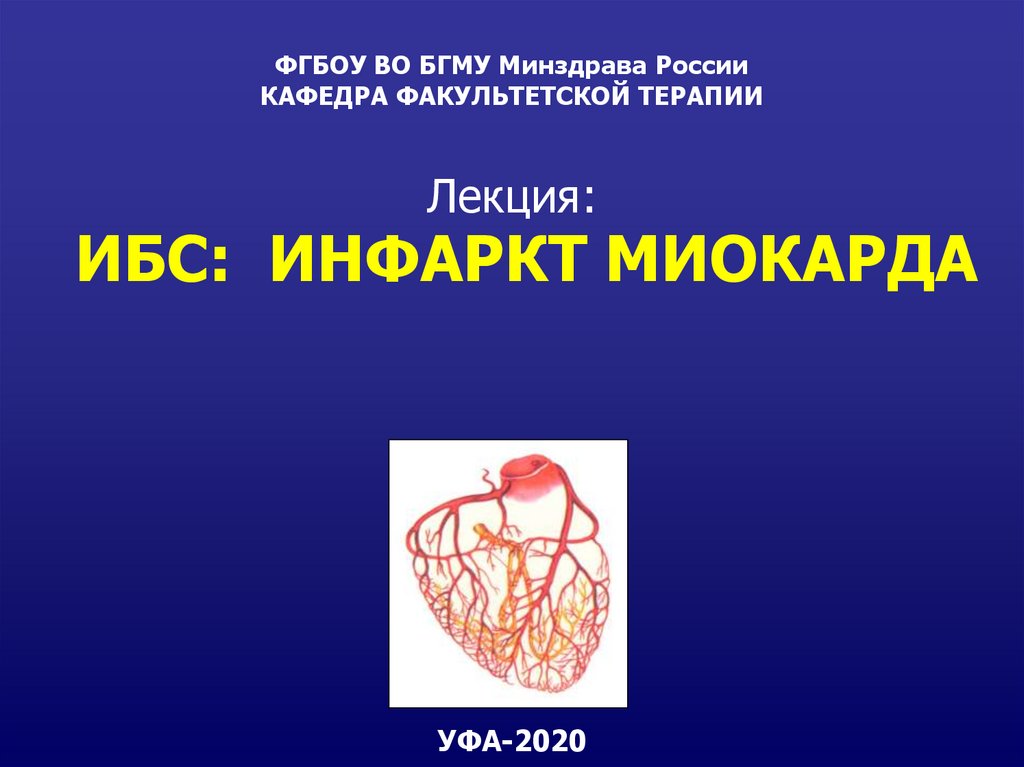 Инфаркт миокарда презентация факультетская терапия