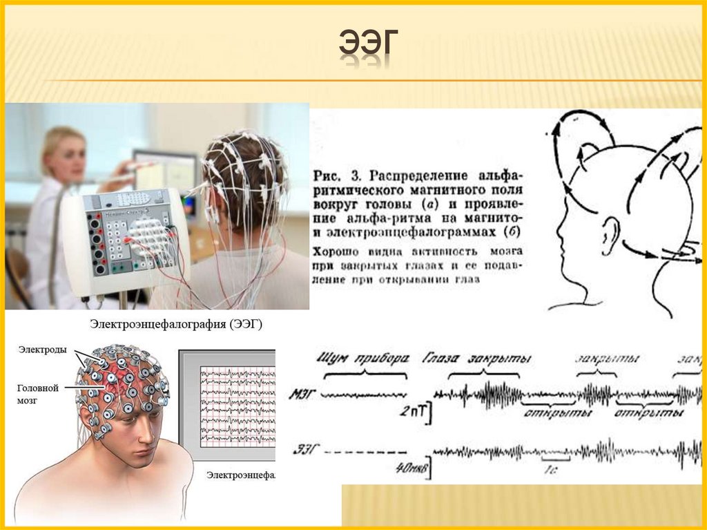 ЭЭГ