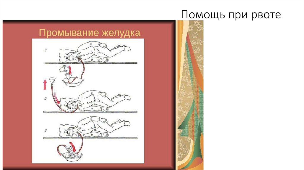 Помощь при рвоте - презентация онлайн