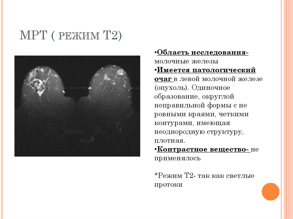 МРТ ( Режим Т2). Вариант №4 - презентация онлайн