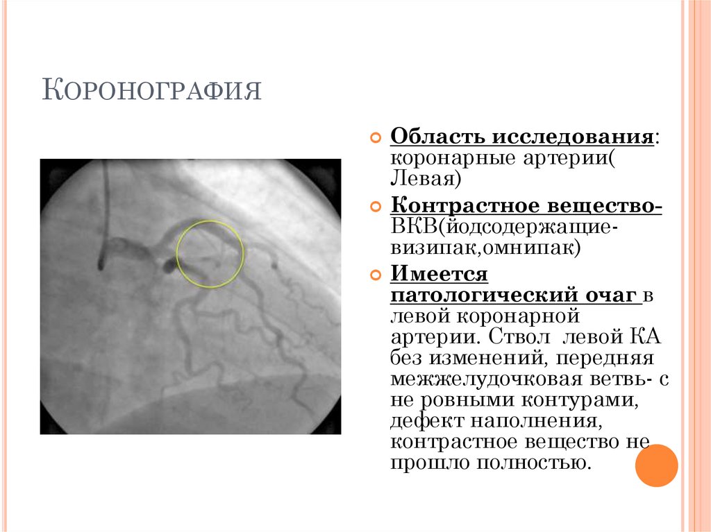 Контрастное вещество при мрт