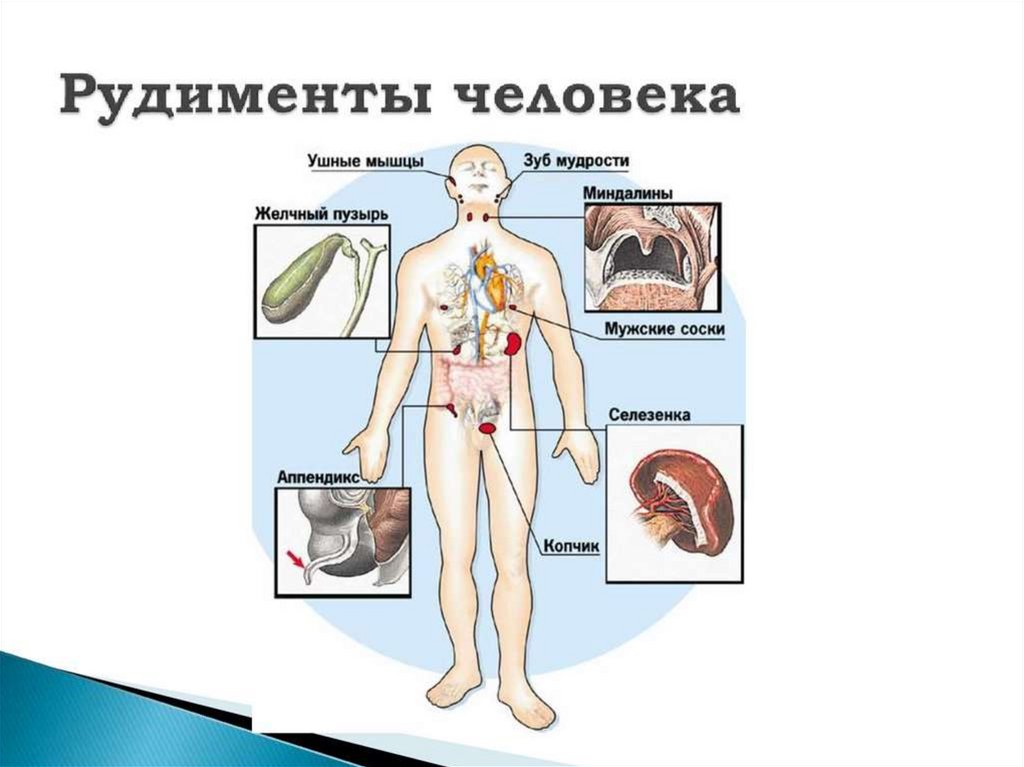 Наличие у животных рудиментов. Рудиментарные органы человека. Рудиментарные органы пример.