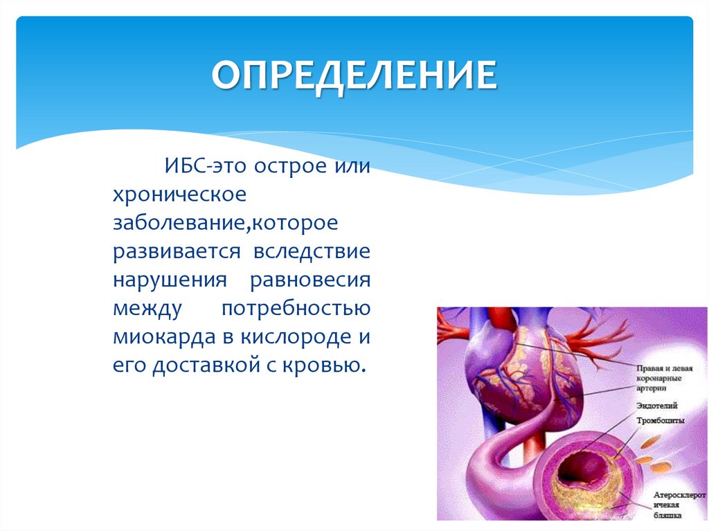 Ибс это. Определение понятия ИБС. Ишемическая болезнь это определение.