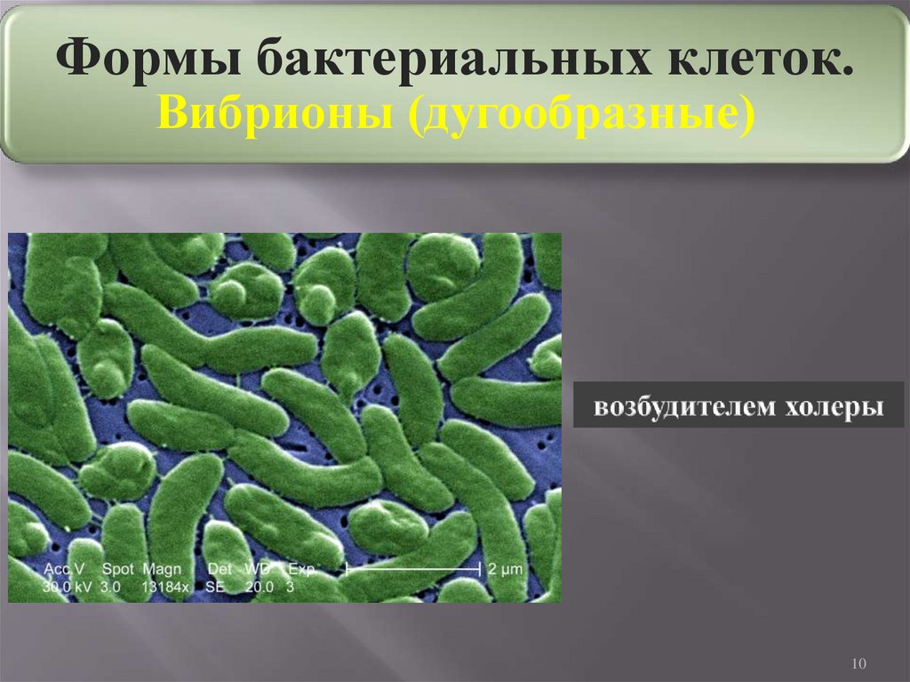 Почему бактерии считают примитивными организмами. Примитивные бактерии. Примитивные организмы. Форма бактерии вибрионы. Формы примитивных организмов.