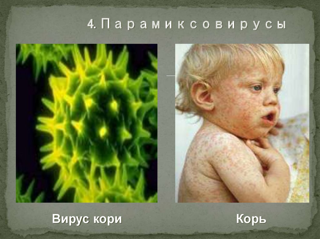 4. Парамиксовирусы