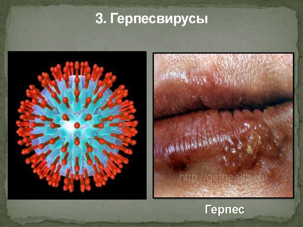 3. Герпесвирусы
