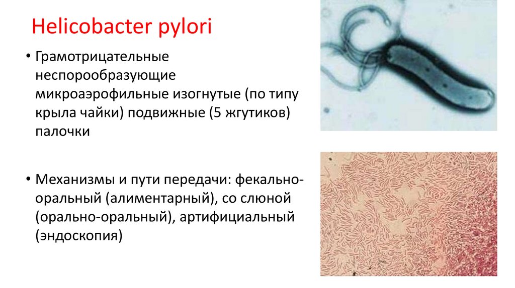 Причины появления хеликобактера. Патогенность хеликобактер пилори. Основные повреждающие факторы Helicobacter pylori. Хеликобактер микроскопия. Хеликобактер пилори морфология.